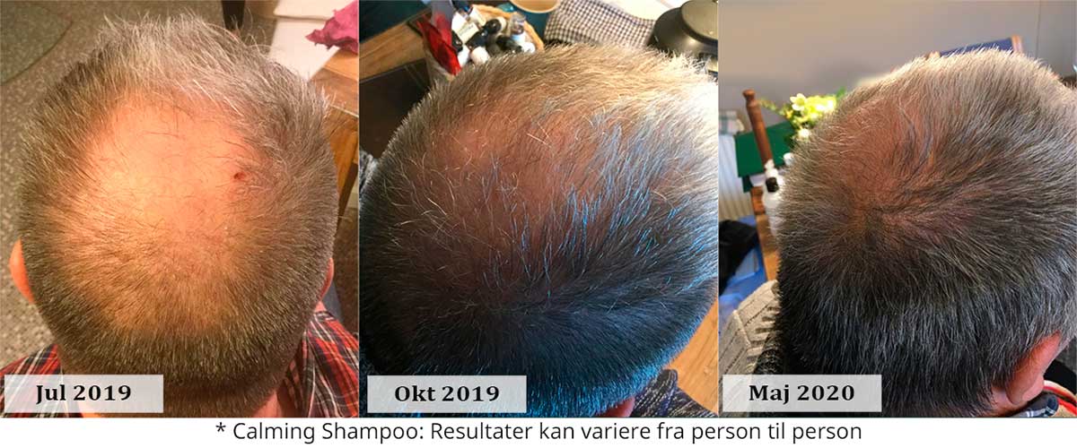 shampoo så håret vokser hurtigere